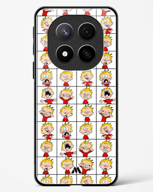 Calvin Making Faces Glass Case Phone Cover (Xiaomi)