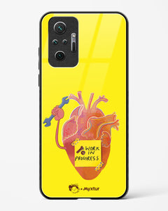 Work in Progress [Doodle Drama] Glass Case Phone Cover (Xiaomi)