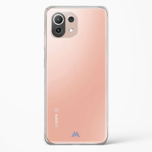 The No Frills Crystal Clear Transparent Case-(Xiaomi)