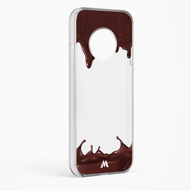 Dripping Chocolate Crystal Clear Transparent Case-(OnePlus)