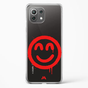 Painted Smiley Crystal Clear Transparent Case-(Xiaomi)